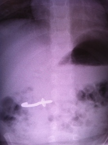 X-ray close up
